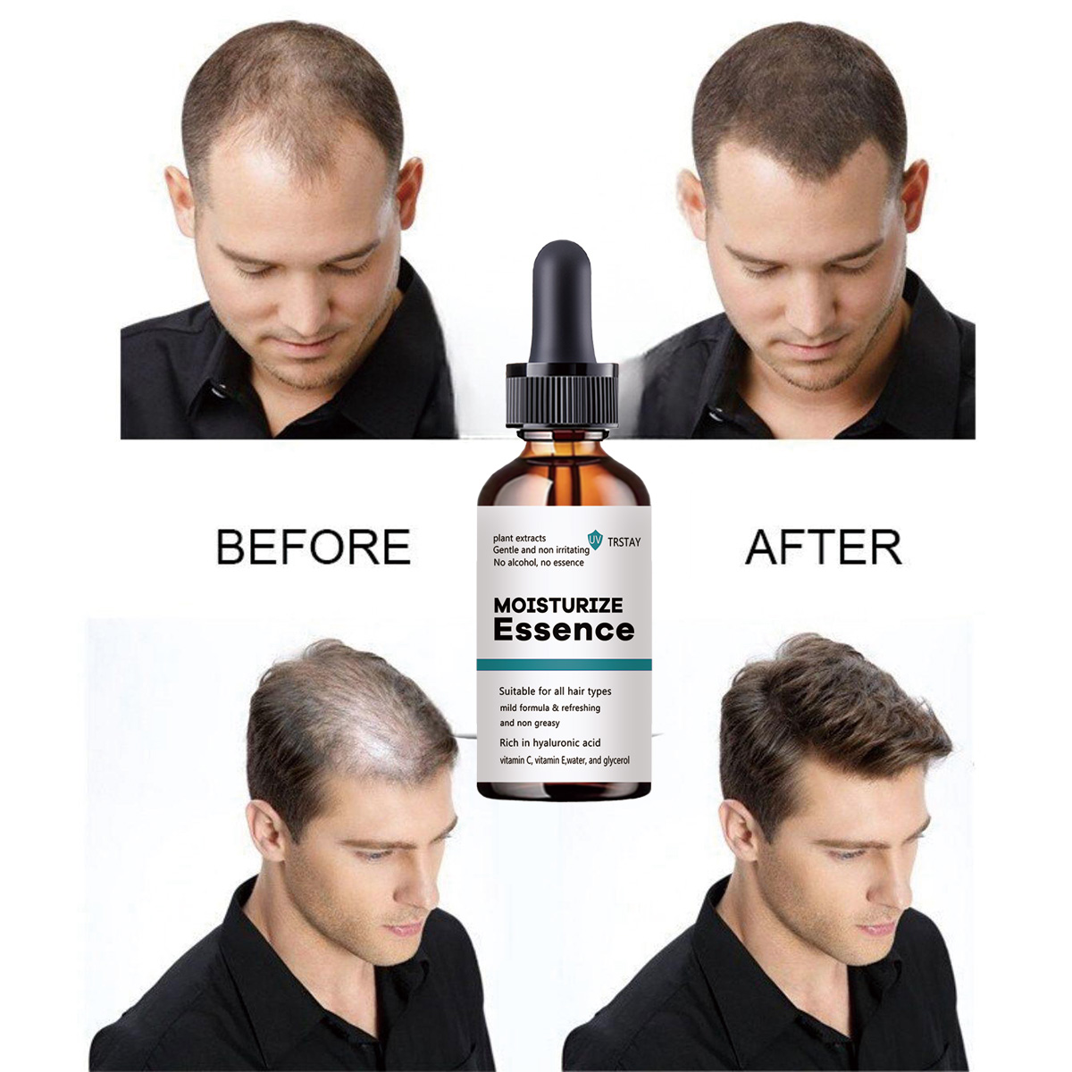 Hair Care Ordinary - 2022 Baru Esensi Pertumbuhan Rambut Mempromosikan