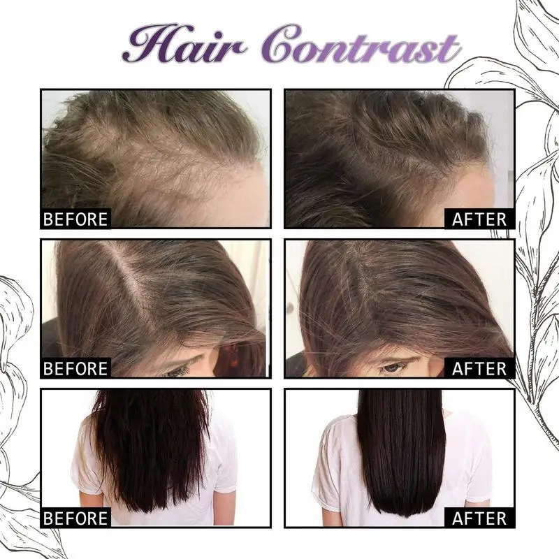 Serum Anti rambut rontok, semp - Hair Care Ordinary ulasan dan harga