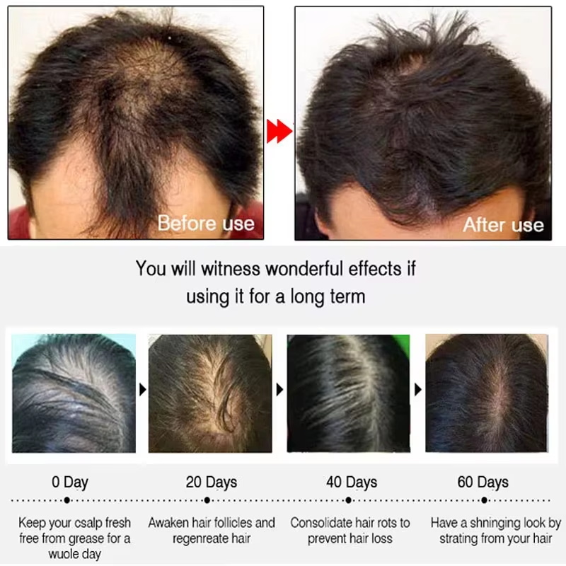Semprotan Penumbuh Rambut Jahe - Hair Care For Men ulasan dan harga